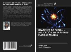 IMÁGENES DE FUSIÓN - APLICACIÓN EN IMÁGENES MAXILOFACIALES的封面