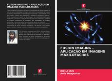 Borítókép a  FUSION IMAGING - APLICAÇÃO EM IMAGENS MAXILOFACIAIS - hoz