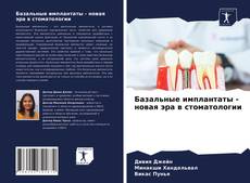 Bookcover of Базальные имплантаты - новая эра в стоматологии