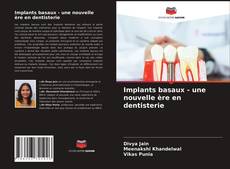 Copertina di Implants basaux - une nouvelle ère en dentisterie