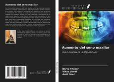 Bookcover of Aumento del seno maxilar