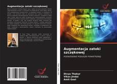 Bookcover of Augmentacja zatoki szczękowej