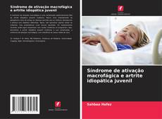 Bookcover of Síndrome de ativação macrofágica e artrite idiopática juvenil