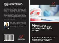 Bookcover of Ortodontycznie indukowana erupcja siekaczy centralnych szczęki