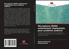 Bookcover of Microphone MEMS entièrement implantable pour prothèse auditive