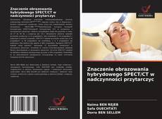 Bookcover of Znaczenie obrazowania hybrydowego SPECT/CT w nadczynności przytarczyc