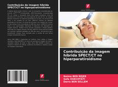 Обложка Contribuição da imagem híbrida SPECT/CT no hiperparatiroidismo