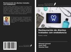 Restauración de dientes tratados con endodoncia的封面