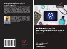 Bookcover of Odbudowa zębów leczonych endodontycznie