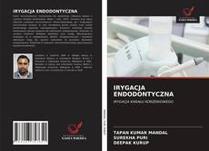 Bookcover of IRYGACJA ENDODONTYCZNA