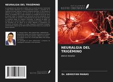 Bookcover of NEURALGIA DEL TRIGÉMINO