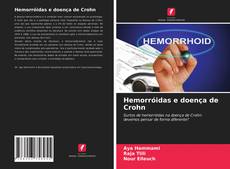 Hemorróidas e doença de Crohn的封面