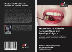 Bookcover of Micofenolato Mofetile nella gestione del Pemfigo Volgare