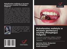 Mykofenolan mofetylu w leczeniu pęcherzycy zwykłej (Pemphigus Vulgaris) kitap kapağı