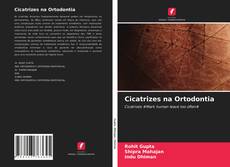 Bookcover of Cicatrizes na Ortodontia