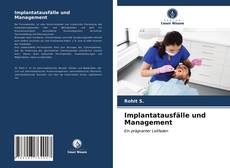 Copertina di Implantatausfälle und Management