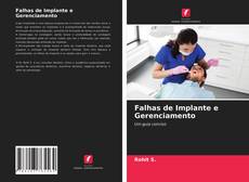 Bookcover of Falhas de Implante e Gerenciamento