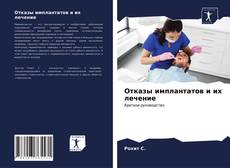 Bookcover of Отказы имплантатов и их лечение