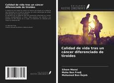 Обложка Calidad de vida tras un cáncer diferenciado de tiroides