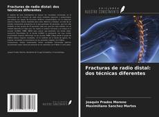 Buchcover von Fracturas de radio distal: dos técnicas diferentes