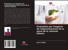 Couverture de Évaluation par imagerie de l'épaississement de la paroi de la vésicule biliaire