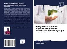 Обложка Визуализационная оценка утолщения стенок желчного пузыря