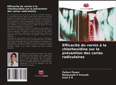 Portada del libro de Efficacité du vernis à la chlorhexidine sur la prévention des caries radiculaires