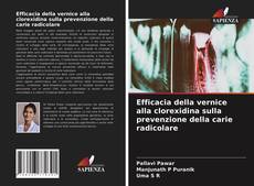 Bookcover of Efficacia della vernice alla clorexidina sulla prevenzione della carie radicolare