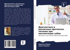 Обложка Диагностика и различные протоколы лечения при имплантации зубов