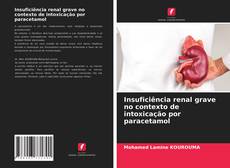 Bookcover of Insuficiência renal grave no contexto de intoxicação por paracetamol