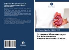 Обложка Schweres Nierenversagen im Rahmen einer Paracetamol-Intoxikation