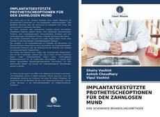 Copertina di IMPLANTATGESTÜTZTE PROTHETISCHEOPTIONEN FÜR DEN ZAHNLOSEN MUND