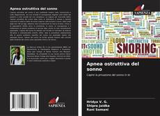 Bookcover of Apnea ostruttiva del sonno