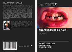 Bookcover of FRACTURAS DE LA RAÍZ