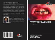 Bookcover of FRATTURE DELLE RADICI