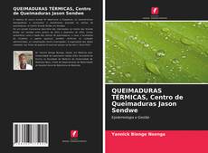 Bookcover of QUEIMADURAS TÉRMICAS, Centro de Queimaduras Jason Sendwe