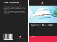 Copertina di Suturas em Odontologia