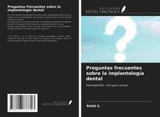 Bookcover of Preguntas frecuentes sobre la implantología dental