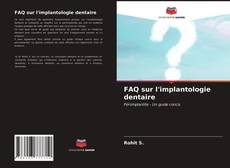 Обложка FAQ sur l'implantologie dentaire