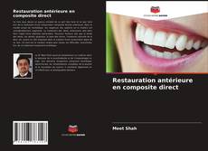 Restauration antérieure en composite direct的封面