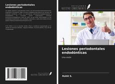 Capa do livro de Lesiones periodontales endodónticas 