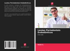 Обложка Lesões Periodontais Endodônticas