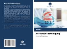 Bookcover of Furkationsbeteiligung