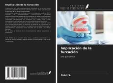 Capa do livro de Implicación de la furcación 