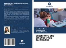 Bookcover of ERKENNUNG UND DIAGNOSE VON ZAHNKARIES