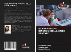 Bookcover of RILEVAMENTO E DIAGNOSI DELLA CARIE DENTALE