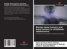 Capa do livro de Benign bone tumors and bone lesions in childhood-adolescence 