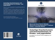 Bookcover of Gutartige Knochentumore und Knochenläsionen im Kindes- und Jugendalter