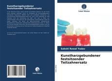 Capa do livro de Kunstharzgebundener festsitzender Teilzahnersatz 