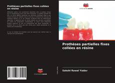 Prothèses partielles fixes collées en résine的封面